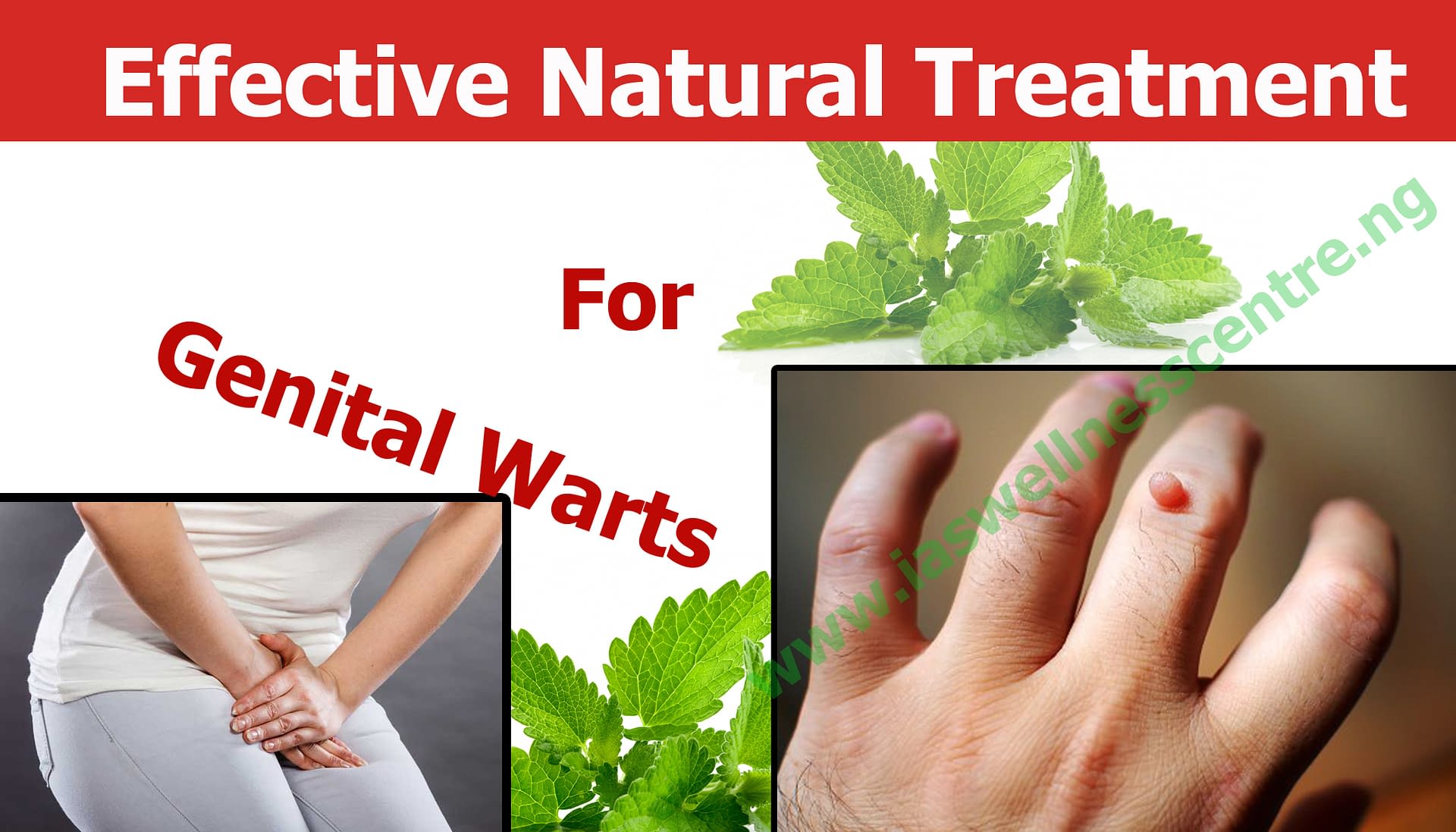 EFFECTIVE NATURAL TREATMENT FOR GENITAL WARTS IN NIGERIA I.A.S Wellness Centre