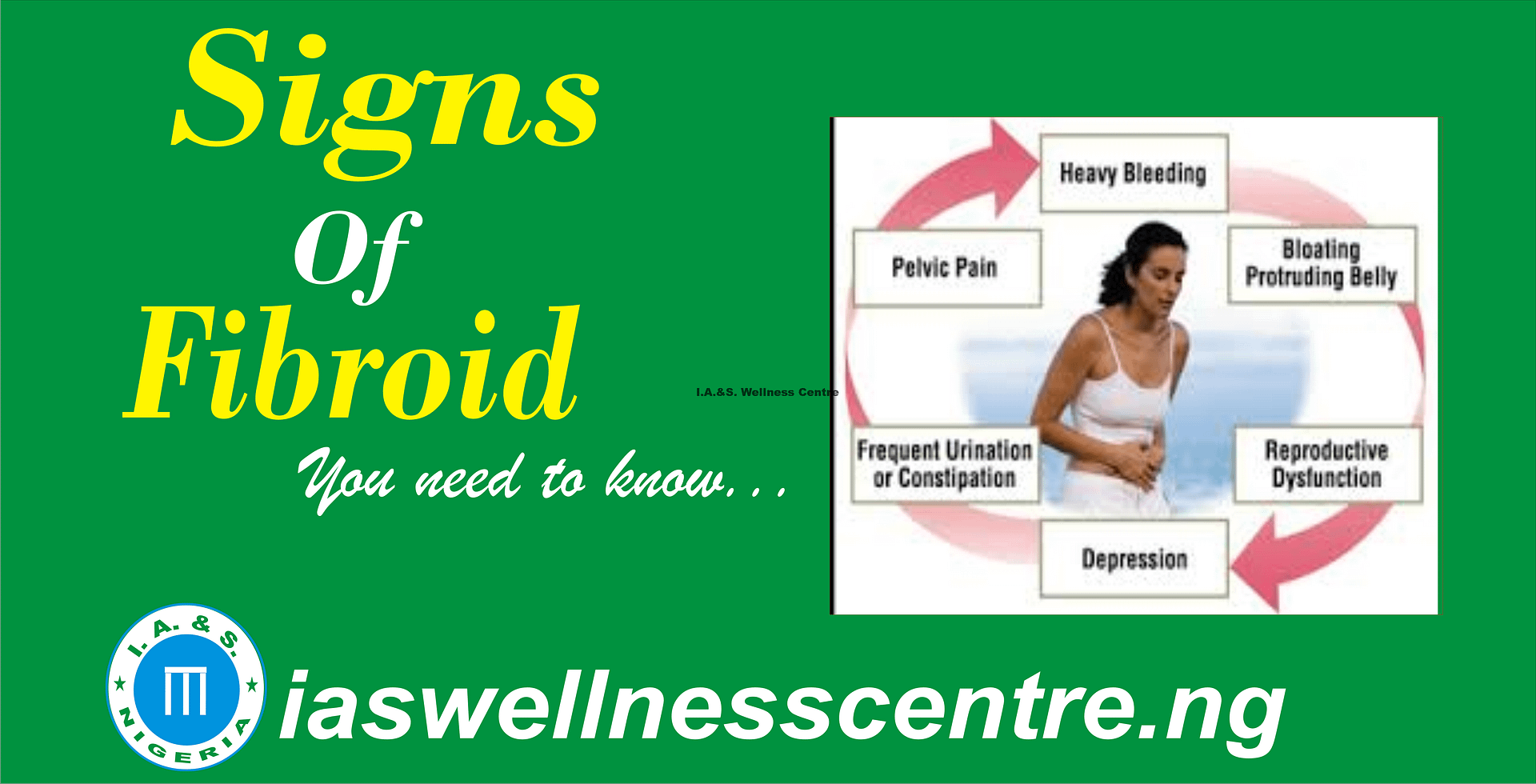 FIBROIDS SIGNS AND SYMPTOMS AND IT'S NATURAL TREATMENT IN NIGERIA I.A